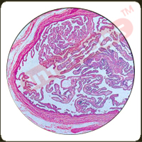 Human Simple Ciliated   Columnar Epithelium. c.s.